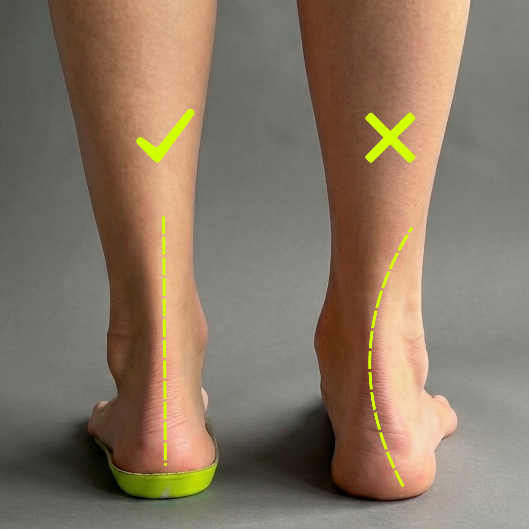 Ankle Pain When Walking: 5 Common Causes and When Insoles Help
