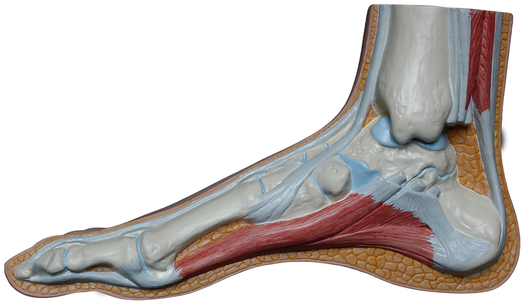 Think you’re suffering from plantar fasciitis? Read this.