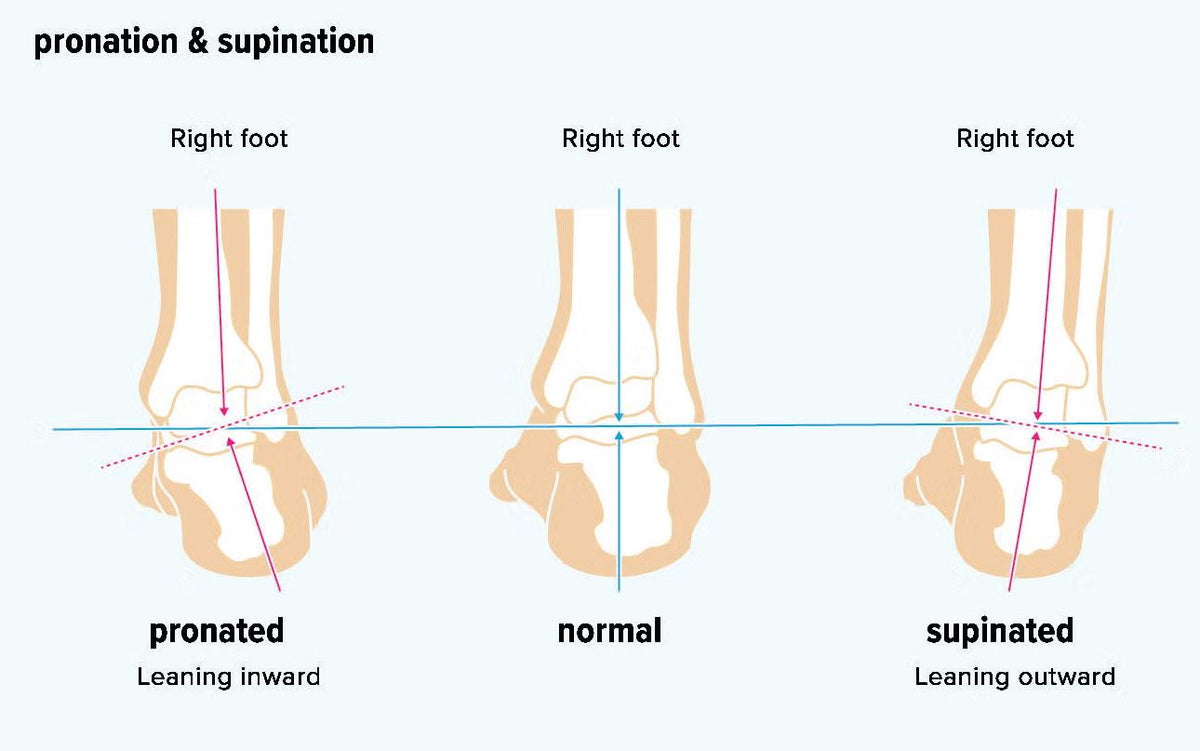 Want to know your foot type? Read this.