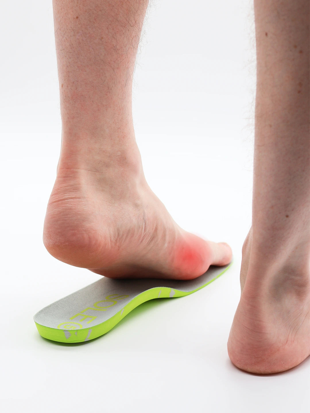 Person wearing a SOLE5 orthotic with a red area on the bunion area indicating pain on a white background