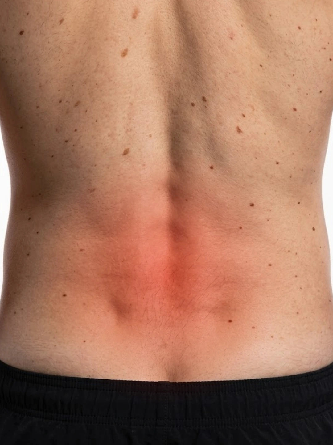 Red area on a person's back indicating back pain with a white background
