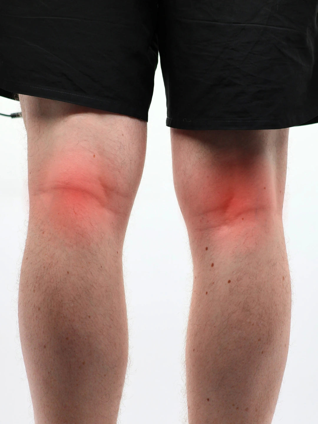 Red areas on a persons knees indicating knee pain on a white background